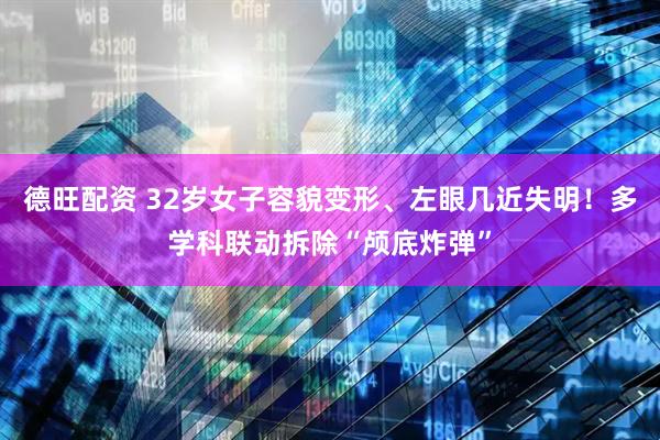 德旺配资 32岁女子容貌变形、左眼几近失明！多学科联动拆除“颅底炸弹”